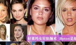 明星爆料打肉毒素视频,真实打肉毒素过程大公开